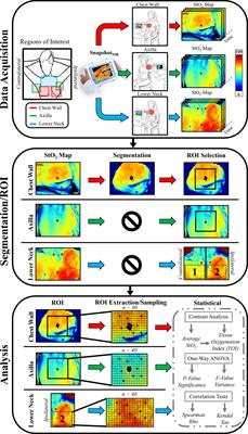 Assessment of Tissue Oxygenation and Radiation Dermatitis Pre-, During, and Post-Radiation Therapy in Breast Cancer Patients